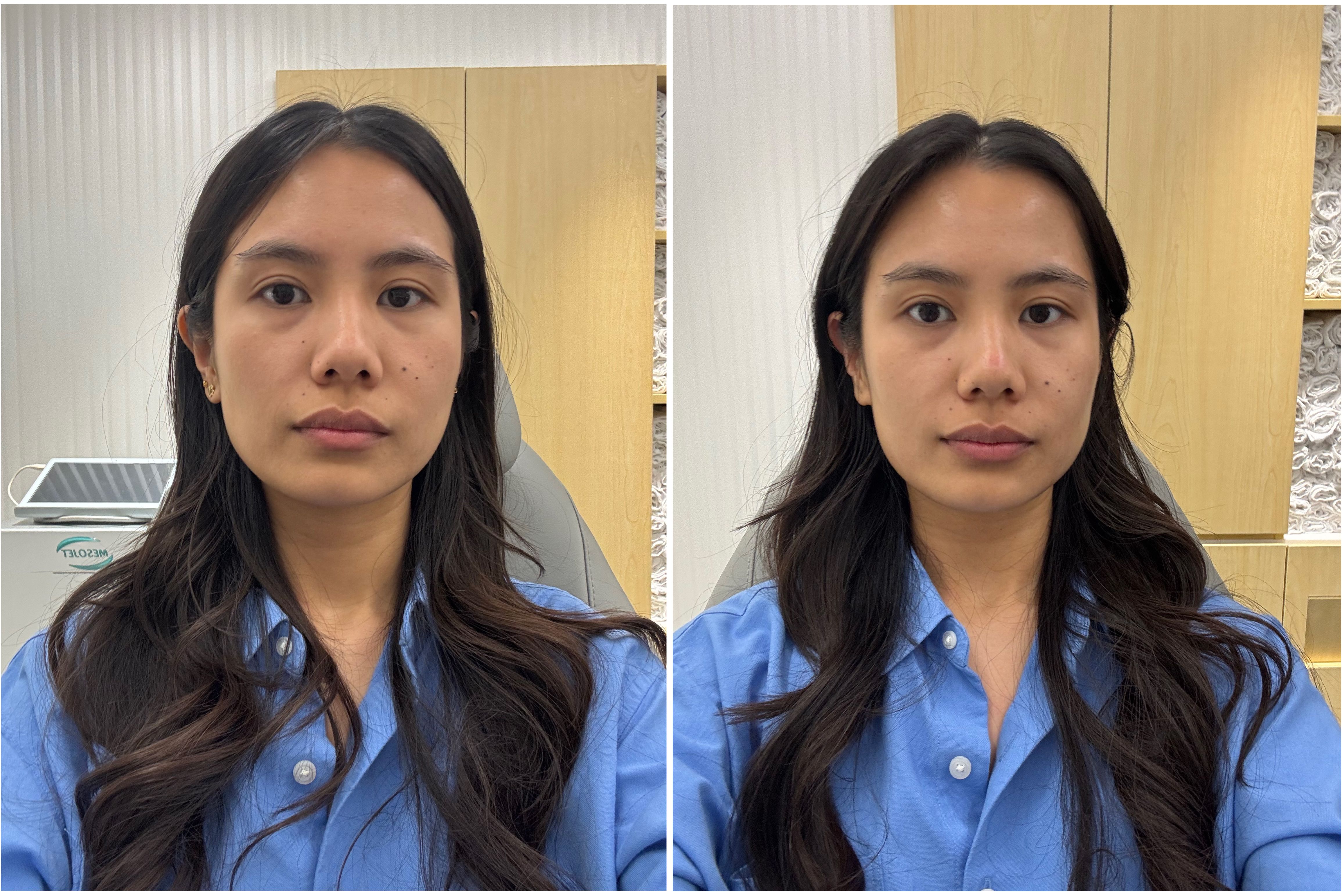 FaceGym results: before and after the Signature Sculpt workout